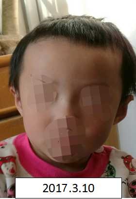 直接喷了12p